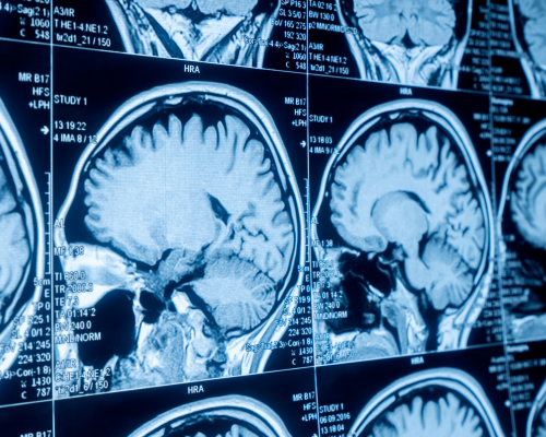 Executive Diploma on Law and Neuroscience: A Comparative Approach