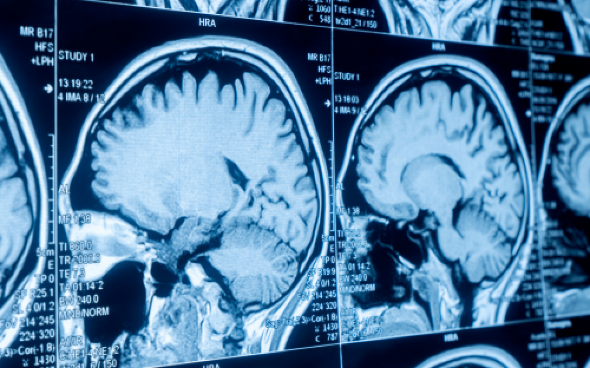 Executive Diploma on Law and Neuroscience: A Comparative Approach
